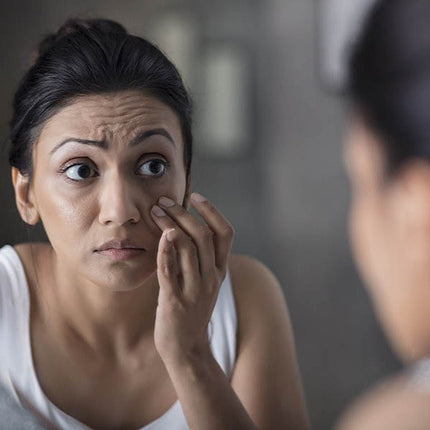 ত্বকের ডার্ক সার্কেল ও চোখের চারপাশের যত্নের সহজ ঘরোয়া উপায়